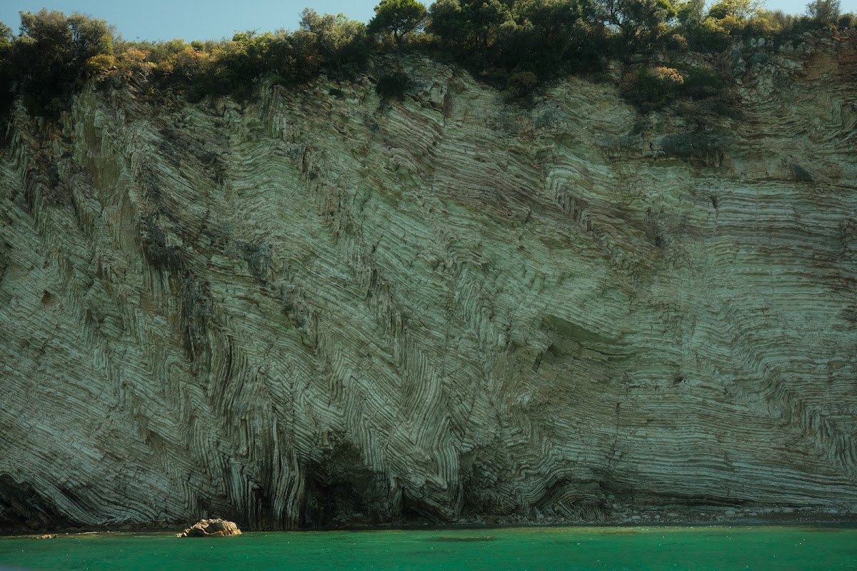 Kepi i këmbës (Leg Cape) photo 5