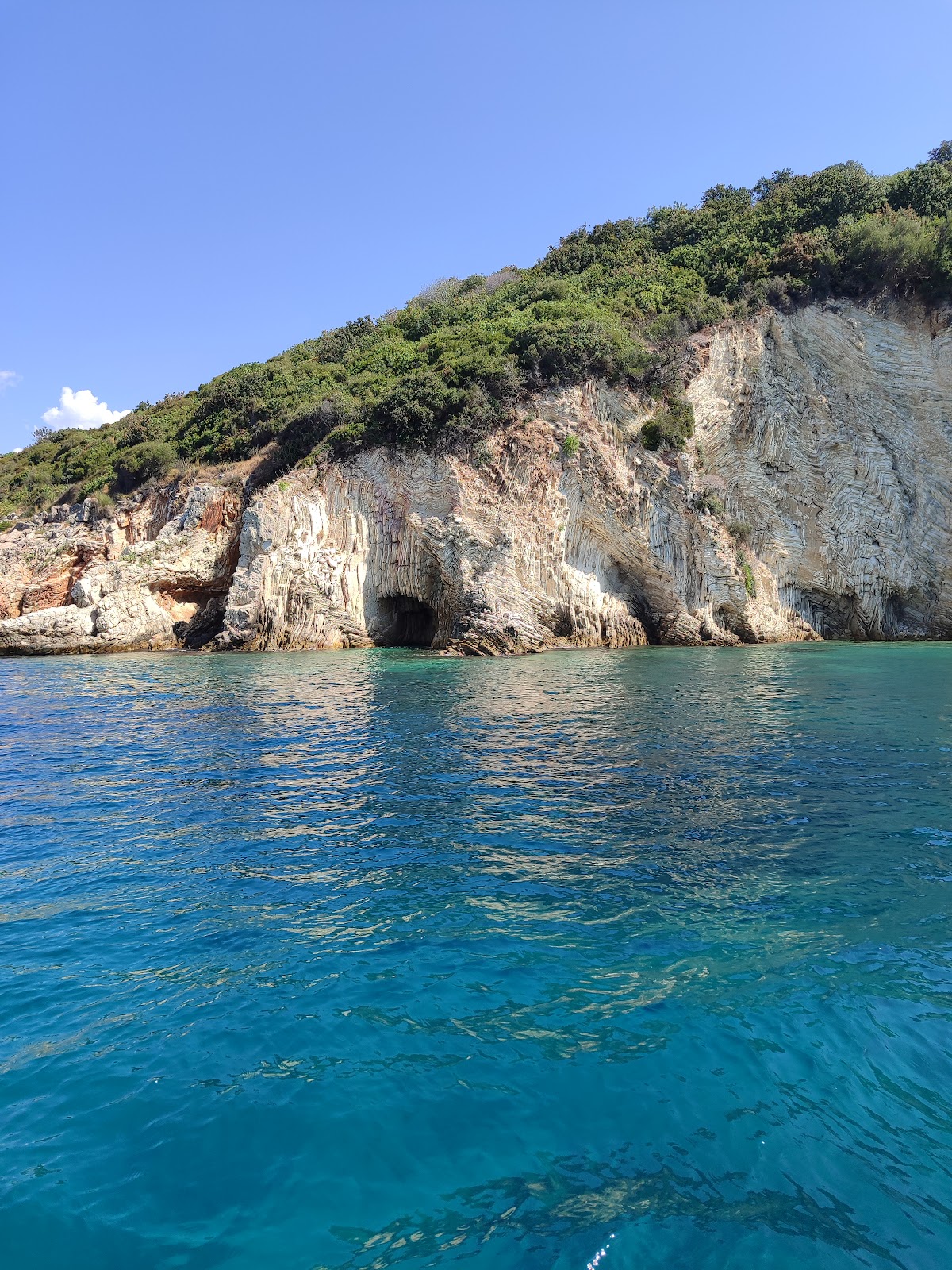 Kepi i këmbës (Leg Cape) photo 4